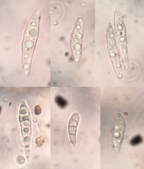 Durella melanochlora