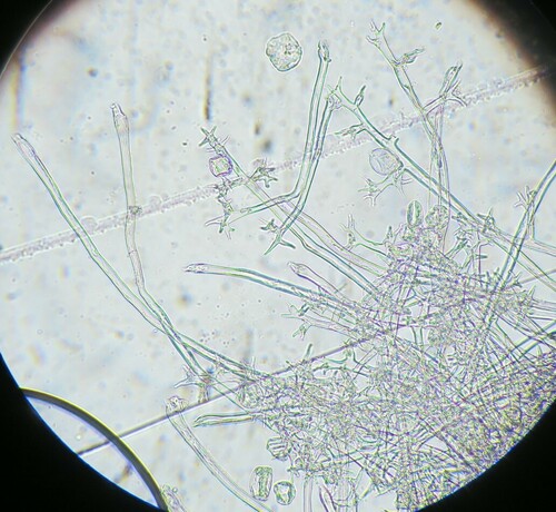 Plasmopara nivea nuotrauka