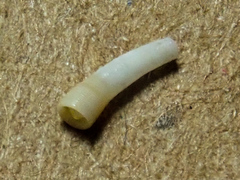 Caecum