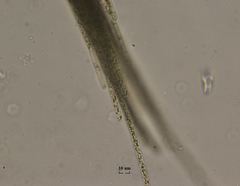 Aphanizomenon flosaquae