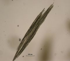 Aphanizomenon flosaquae