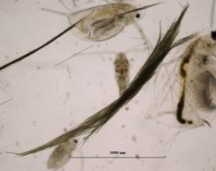 Aphanizomenon flosaquae