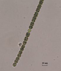 Dolichospermum