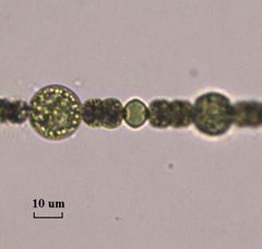 Dolichospermum