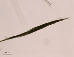 Aphanizomenon flosaquae