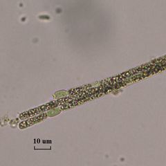 Aphanizomenon flosaquae
