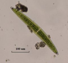 Closterium moniliferum