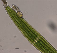 Closterium acerosum lanceolatum