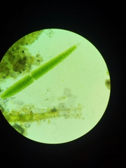 Pleurotaenium trabecula