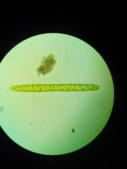 Pleurotaenium trabecula