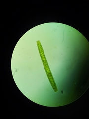 Pleurotaenium trabecula