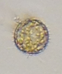 Entamoeba coli