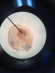 Chydorus sphaericus