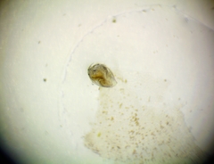 Chydoridae