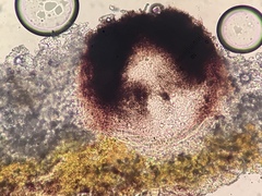 Anisomeridium biforme