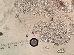 Anisomeridium biforme