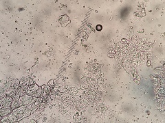 Anisomeridium biforme