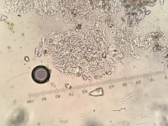 Anisomeridium biforme