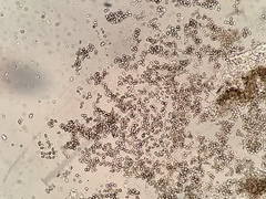 Lichenoconium erodens