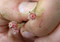 Microstoma floccosum