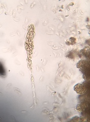 Cryptovalsa prominens