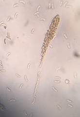 Cryptovalsa prominens