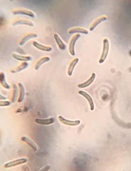 Cryptovalsa prominens