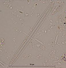 Bacillaria paxillifera