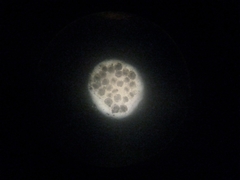 Echinococcus granulosus