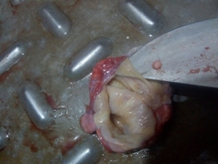 Echinococcus granulosus