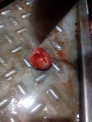 Echinococcus granulosus