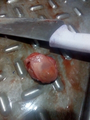 Echinococcus granulosus