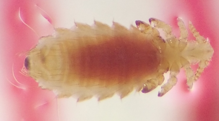 Spiny rat louse