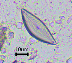 Encyonema
