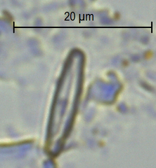 Achnanthidium minutissimum