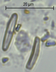 Achnanthidium minutissimum