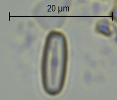 Achnanthidium minutissimum