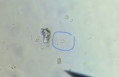 Tetradesmus dimorphus