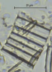 Fragilaria capucina