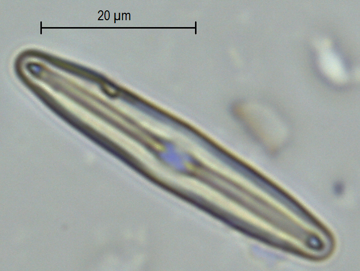 Frustulia vulgaris