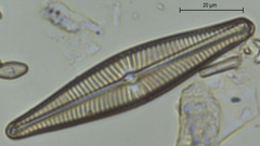 Navicula rhynchocephala