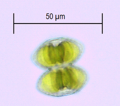 Staurastrum punctulatum