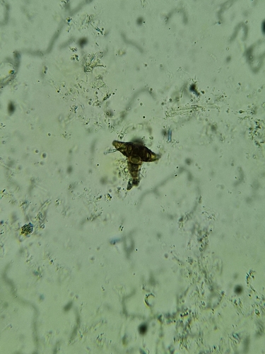 Asterosporium asterospermum observed 2024-05-25