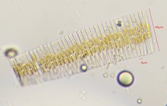 Fragilaria