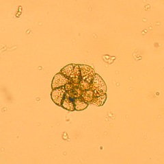 Foraminifera