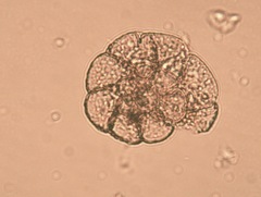 Foraminifera
