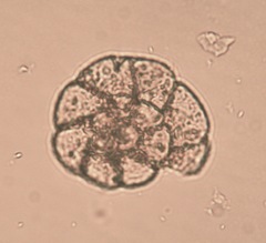 Foraminifera