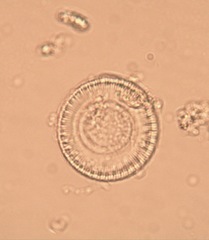 Cyclotella