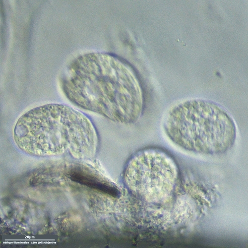 (Colpoda steinii)