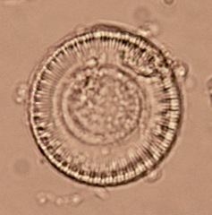 Cyclotella